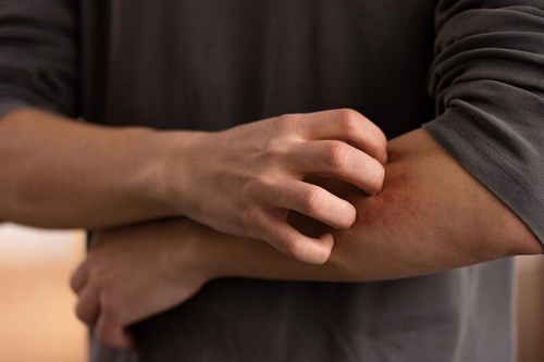 ayurveda Skin Diseases treatement in pathanamthitta